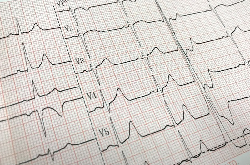 ホルター心電図計