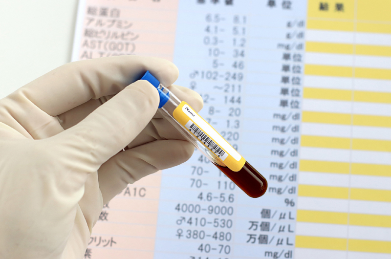 24時間の血糖トレンドを知るメリット